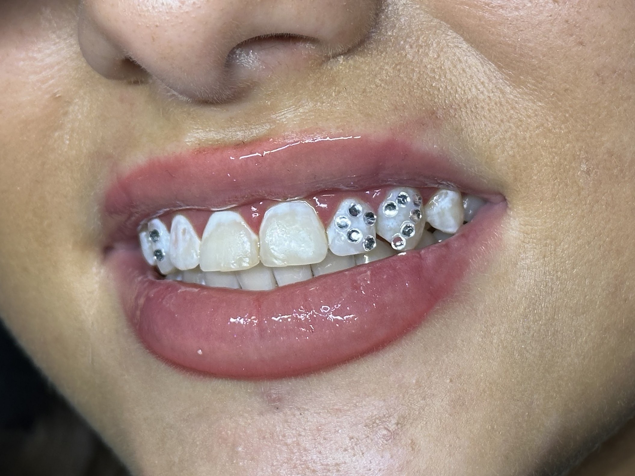 Glimlach met een rij heldere tooth gems